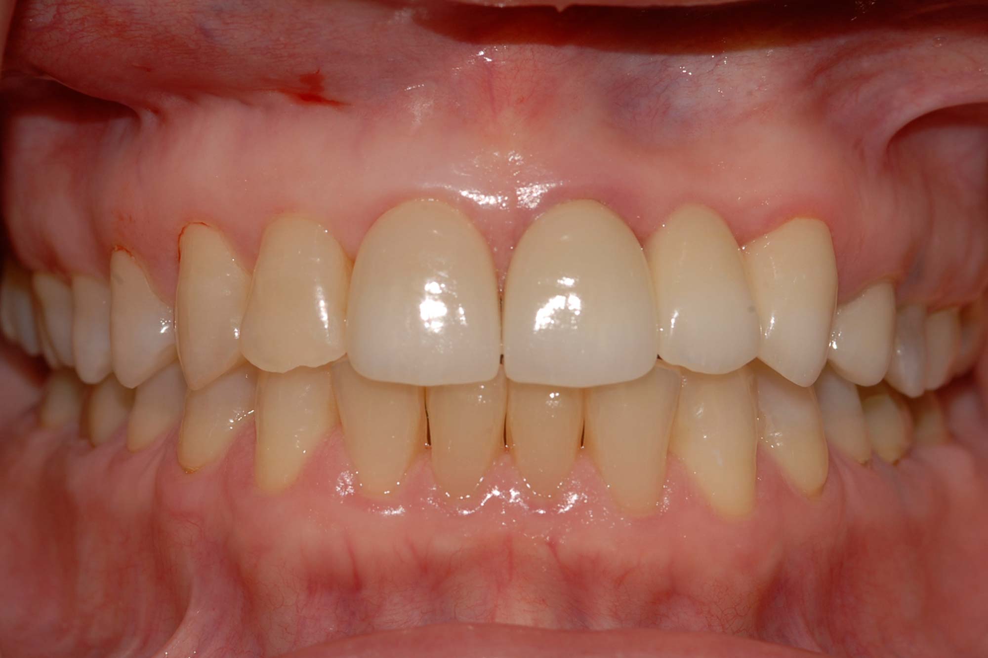good teeth after photo at Waddell Restorative Dentistry in Germantown, TN.