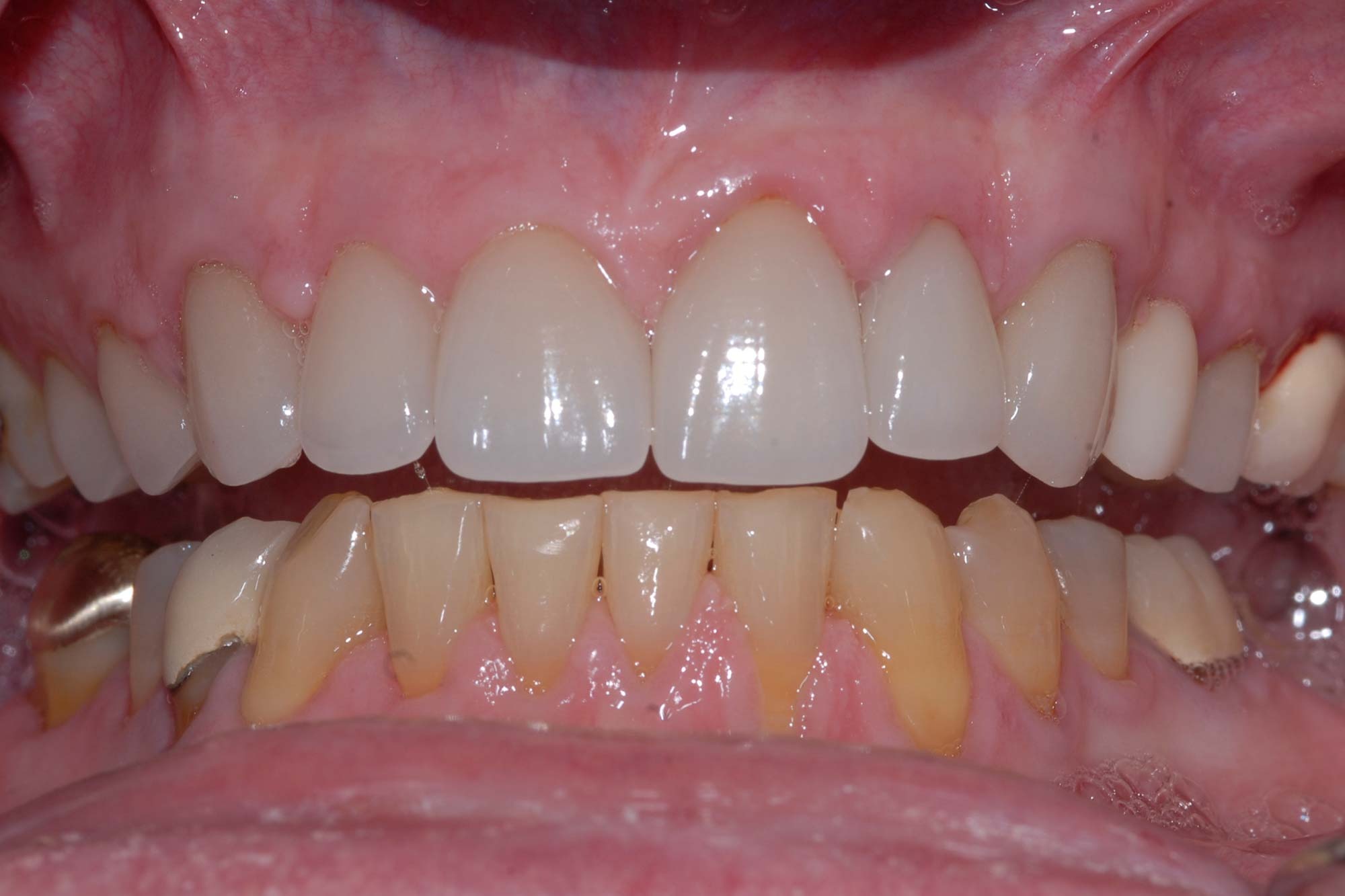 Healthy Smiles img<br />
