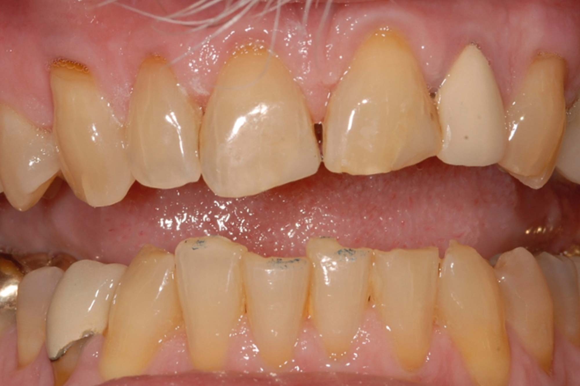 Healthy Smiles img<br />
